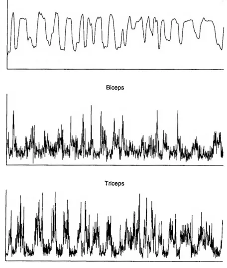 Figure 2.6:  Exemple du  «Multiple channels with no  adaptive whitening».