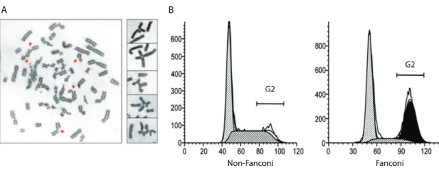 Figure 1.3  : Aspects cellulaires de l’anémie de Fanconi. Les cellules des patients Fanconi soumises à un traitement  au DEB présentent l’apparition de formes chromosomiques quadrilatérales au cours de la métaphase (A) et un blocage  du cycle cellulaire en