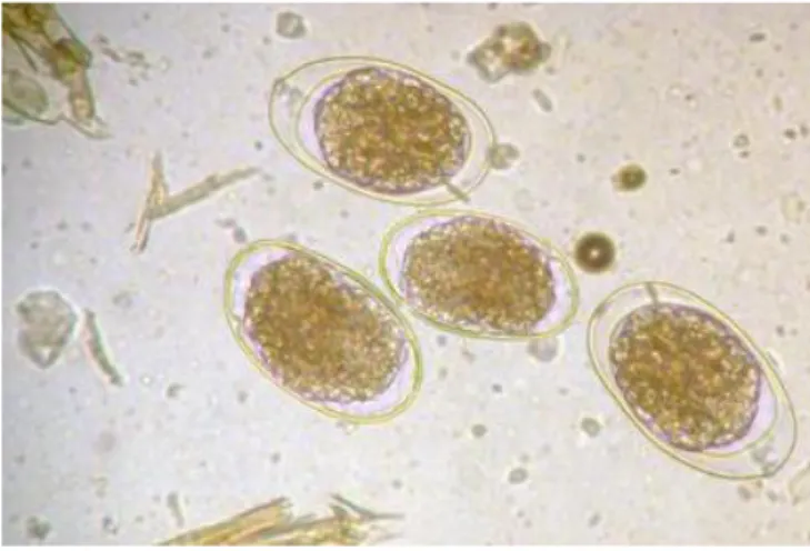 Fig.  6  :  Œufs  de  strongles  d’ovins  observés  à  l’objectif  x40  au  microscope,  photographie  de  S
