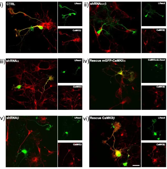 Figure 9 : Étude de l’inhibition par shRNA de la CaMKII dans le développement.  Neurones  de  4   jours   marqués   en  rouge   avec  l’anticorps  Mouse  anti-CaMKII et  transfectés  avec  le  marqueur  Lifeact-mGFP,  avec  ou  sans  plasmides  codants  po