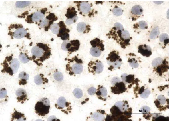 Figure 10. Cytopsin de sang contaminé par B. henselae  (Grossissement d’origine x400)