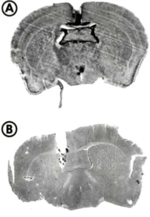 Figure  1:  Photopraphles  de  coupes  histologiques  de  cerveaux  de  souris:  évaluation  de  la  coordonnée  du  ventricule  latérale  gauche