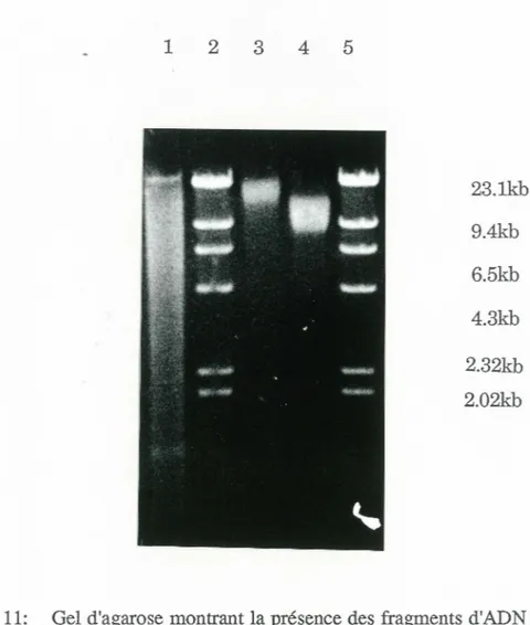 Figure 11:  Gel d'agarose montrant la présence des fragments d'ADN d'hybridomes de  22 et 17.5Kb purifiés
