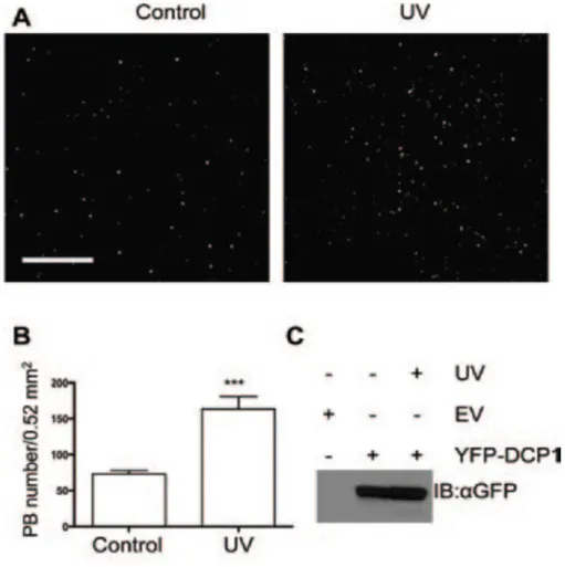 Figure 7. L’irradiation aux UVs induit une augmentation du nombre de PBs. (A) YFP-DCP1 et  AtPIP2A-mCherry  ont été  exprimés  de  manière  transitoire dans des feuilles de  plantes Nicotiana  benthamiana  et  un  stress  UV  a  été  appliqué  à  une  moit