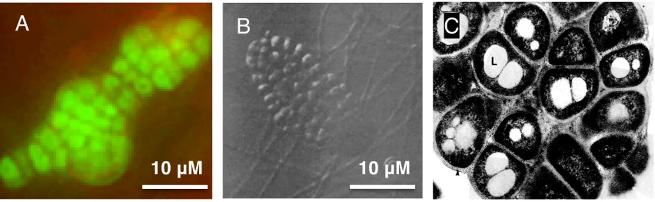 Figure 3:  Les  sporanges  retrouvés  chez  Frankia  spp.  (A)  le  sporange  chez  Frankia  alni ACN14a en microscopie à épifluorescence, coloré avec le colorant LIVE/DEAD®  à  un  grossissement  total  de  1000x,  (B)  le  sporange  de  Frankia  sp