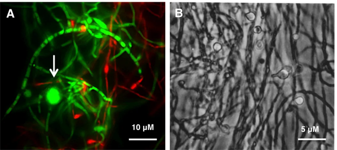 Figure 4: Les vésicules retrouvées chez Frankia spp. A) une vésicule de Frankia alni  ACN14a en microscopie à épifluorescence,  colorée avec le colorant  LIVE/DEAD®  à  un grossissement total de 1000x, la flèche blanche pointe une vésicule, B) vésicules  d