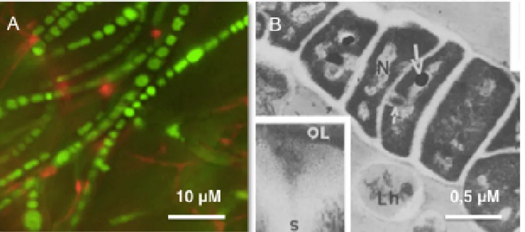 Figure 5:  Le  morphotype  toruleux  retrouvé  chez  Frankia  spp.  (A)  l'hyphe  toruleux  chez Frankia alni ACN14a en microscopie à épifluorescence, coloré avec le colorant  LIVE/DEAD® à un grossissement total de 1000x, (B) l'hyphe toruleux chez la souch