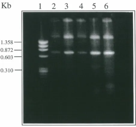 Figure 9.  Isolement del' ARN total de lymphocytes T périphériques humains par l'usage  du réactif TRI-REAGENT LS