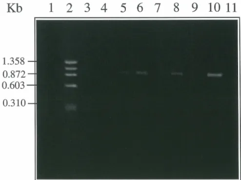 Figure 10.  Produits d'amplification de chaînes  V~3  de TCR obtenus lors de la première  amplification par PCR