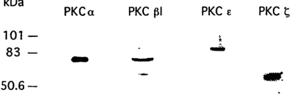 Figure 3: Isoformes de PKC exprimés par la lignée de cellules endotJiéliales ECV 304. L'extrait protéique total (50 (ig) a été séparé sur SDS-PAGE, transféré sur membrane de nylon, incubé avec les anticorps anti-PKC appropriés puis avec un  anti-lg  couplé