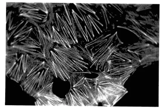 Figure 7a.  Mise en évidence des filaments d'actines des cellules ECV 304 par fluorescence
