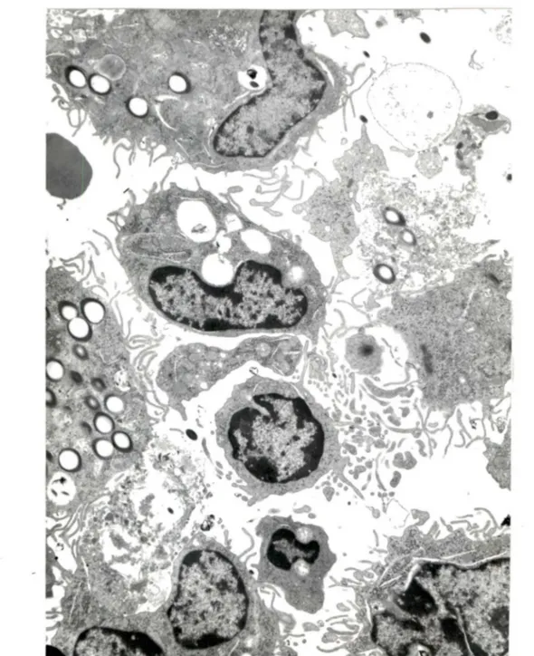 Figure  5.  Macrophages  contenant  du  latex  (X5426) 