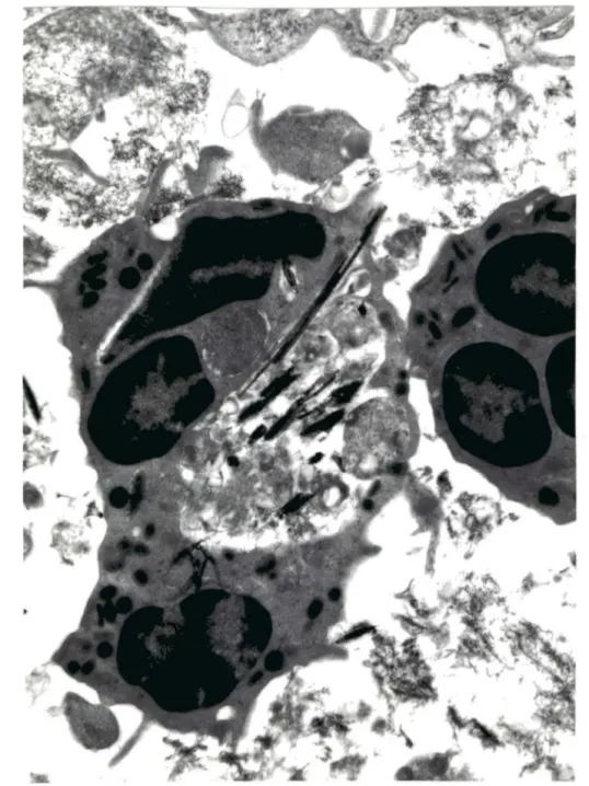 Figure  7.  PMN  neutrophiles  phagocytant  des  fibres  (Xl3760) 