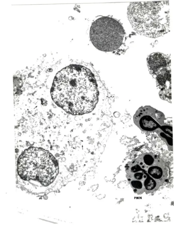 Figure  13 .  MA,  avec  fibres,  en  voie  de  dégénérescence  (X5426 ) 