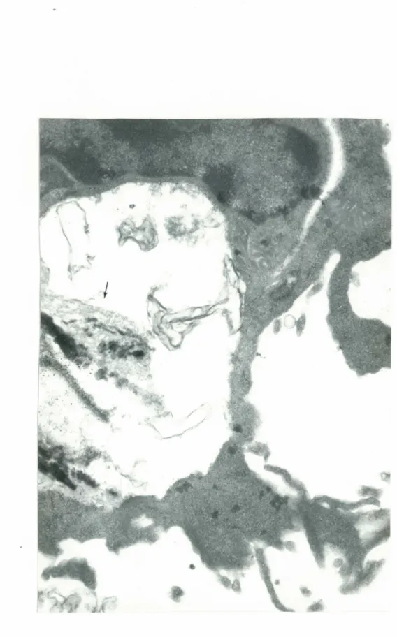 Figure  17.  Tentative  de  lyse  de  la  chrysotile  par  un  MA  (X34884) 