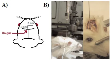 Figure 2 : Coordonnées et technique d'implantation 