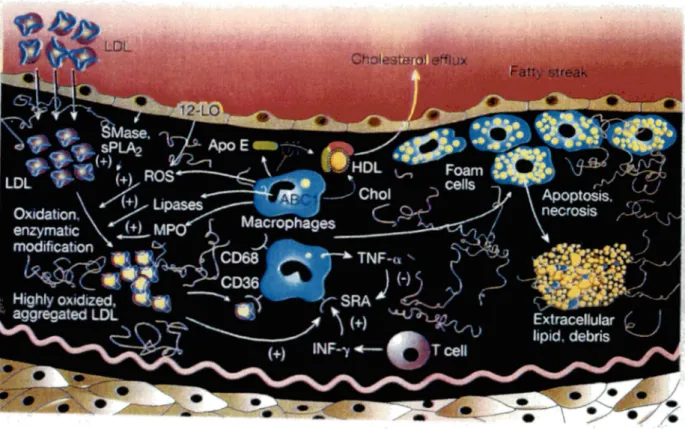 Figure 2  Formation de la plaque d'athérosclérose 