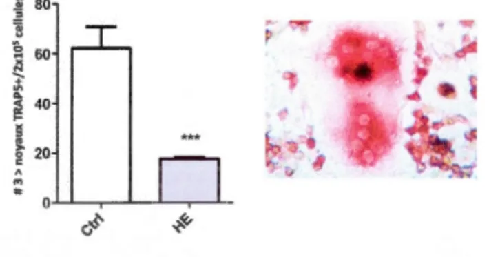 Figure  2.3:  Effet  de  l'hémine  (HE)  sur  l'ostéoclastogenèse  in  vitro.  Les  cellules  de  la  moelle ont  été  récupérées  et  mises  en culture