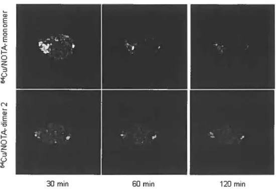 Fig. 5 Decay-corrected transaxial microPET images of PC3 tumor-bearing mice  at 30, 60 and 120 minutes post-injection of  64 Cu/NOTA-monomer or  64 Cu/NOT  A-dimer 2