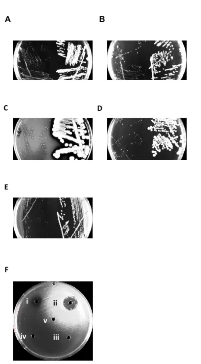 Fig. 2.  Typical colony sizes for SCV and prototypic strains (left and right sides of the  plates,  respectively)  for  (A)  S