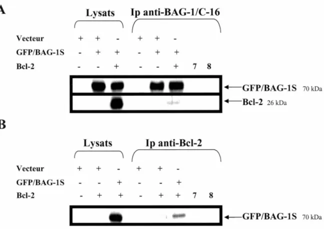 Figure 12  : Coimmunoprécipitation de Bcl-2 et BAG-lS. 