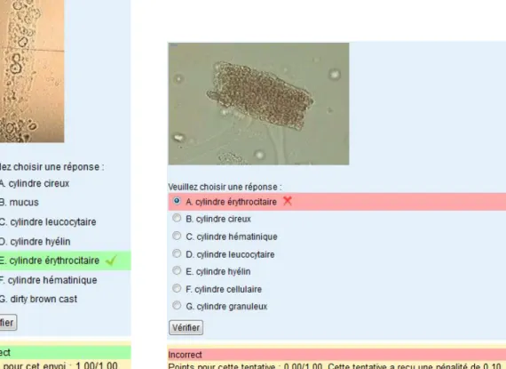 Figure 6  Capture d’écran démontrant une rétroaction sur Moodle lors d’une question  Les activités proposées telles que les QCM, les questions ouvertes à réponses  courtes, les histoires de cas du simple au complexe, sont des situations présentes sur  l’in