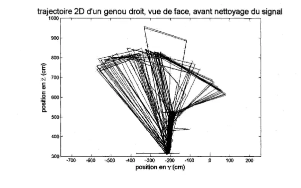 Figure 2.7:  La trajectoire du genou dans  le  plan frontal  avant que  les  erreurs causées  par les  données  manquantes  ne soient  corrigées