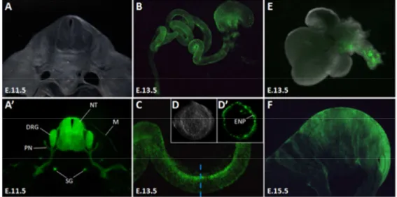 Figure 5: Characterization of Cdx2NSE-Cre activity in the neural crest lineage.   Analyses of E11.5 (A, A’),  E13.5 (B-E) and E15.5 (F) embryos obtained from crosses between Cdx2NSE-Cre and R26R-YFP reporter  mice