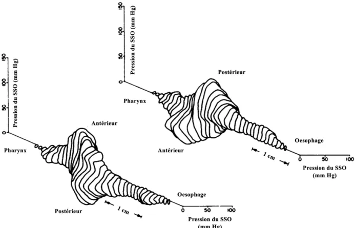 Figure 8. Représentation tridimensionnelle de la pression au niveau du SSO humain  normal