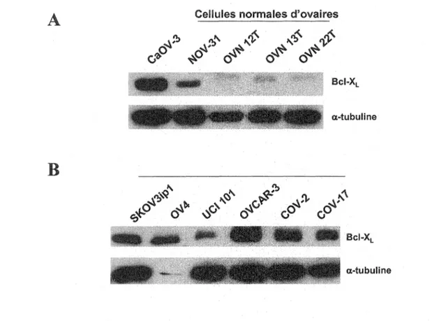 Figure 9.  Expression de  fa  protéine  Bd-XL  dans des cellules humaines d'ovaires  L'analyse  par  immunobuvardage  de  type  Western  de  l'expression  de  Bel-XL  a  été  effectuée sur des extraits protéiques de cellules humaines d'ovaires
