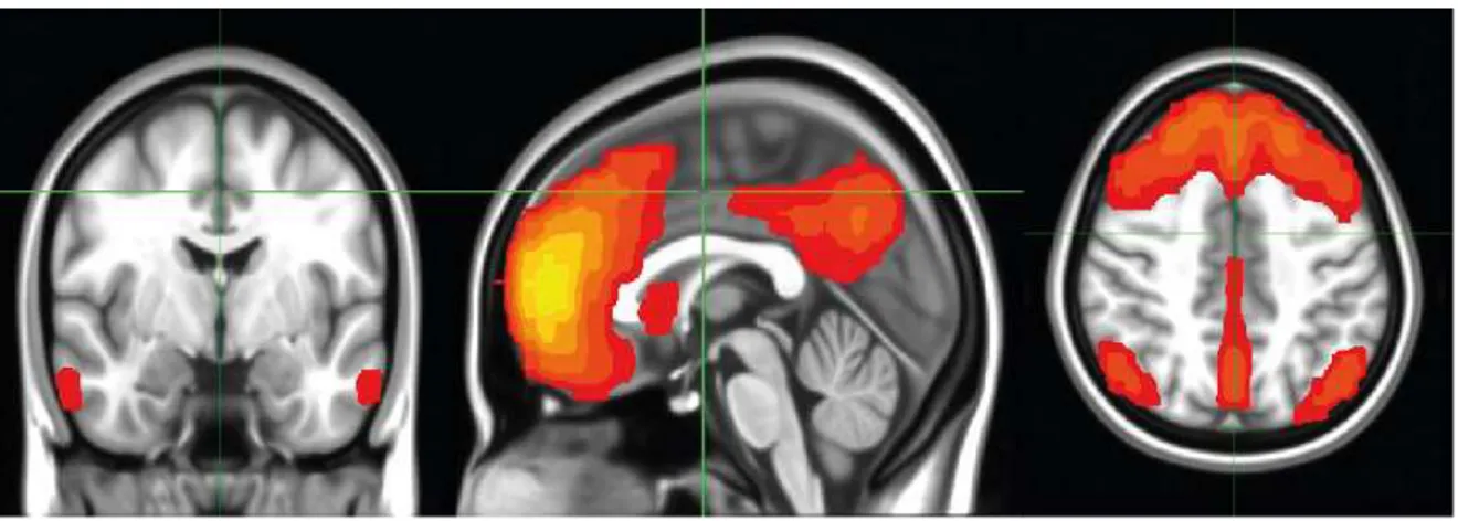 Figure 3 : the default mode network 