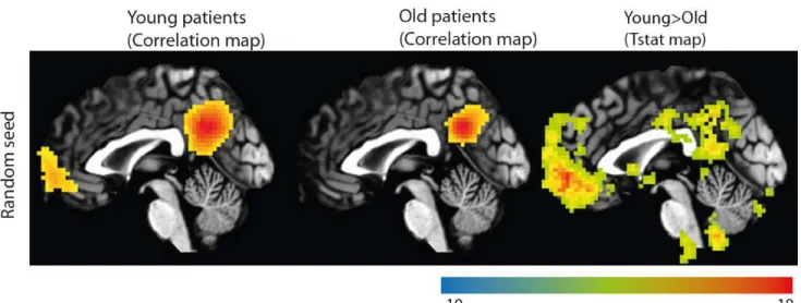 Figure 4 : Age related differences in the DMN 