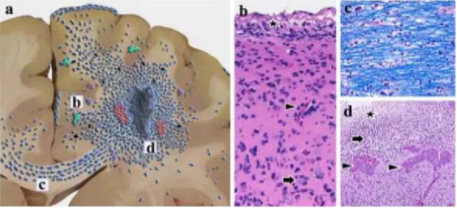 Figure 7: Migration pattern of glioma cells. 