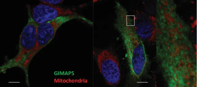 Figure 4- 13:  GIMAP5v2 does not colocalize with mitochondria. 