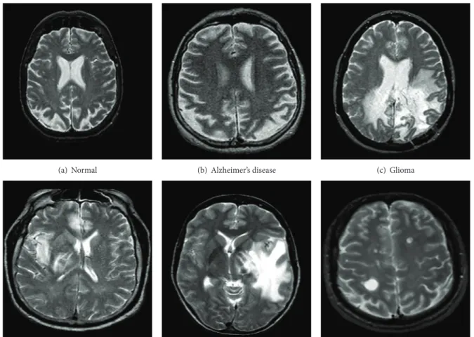 Figure 2: Examples of retina images.