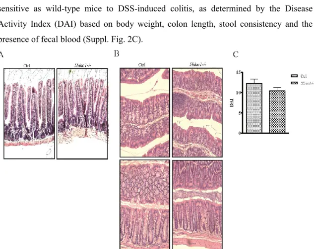 Figure 7 Supplementary Figure 2. Conditional intestinal epithelial Hdac1 deletion  does  not  alter  significantly  intestinal  homeostasis