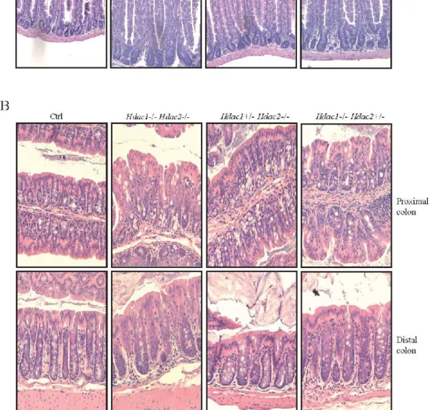 Figure  9  Figure  1.  One  allele  of  IEC-specific  Hdac2  is  insufficient  to  maintain  normal  intestinal  architecture