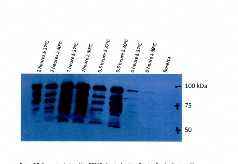 Figure 3.9. Expression  de  la  protéine DDX1 0  dans les  bactéries  Rosetta. Ces dernières ont été  transformées avec le  plasmide pGEX-DDX1 O L'.N et  induites avec I'IPTG sous différentes conditions  en  alternant la  température entre 30  °C  et 37  °