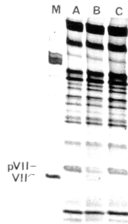 FIGURE 4-Test d'activité  de  la protéase insolubilisée. 