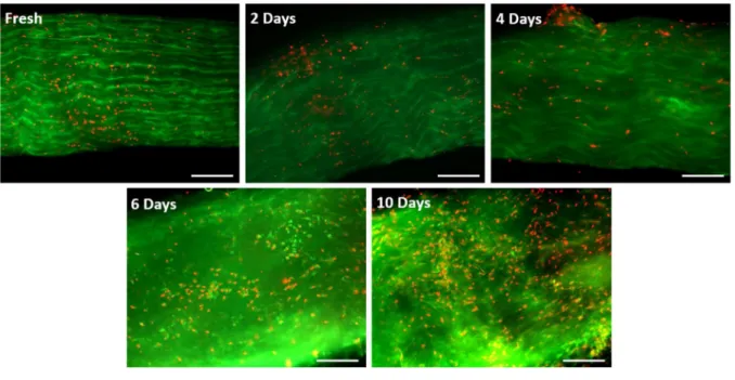 Figure 3.2 Typical fluorescence micrographs obtained from freshly isolated tendons  experiencing 2, 4, 6, and 10 days of stress deprivation