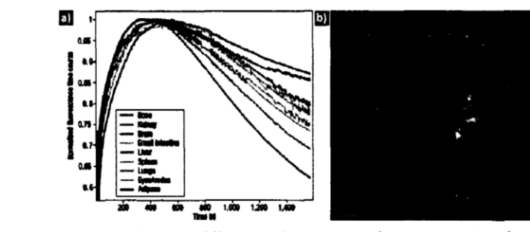 Figure  2.11  Résultat  de  Hillman  et  Moore  pour  la  segmentation  des  organes  par RMCNN avec V ICG