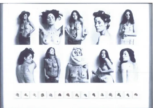 Figure 3.2 Hannah Wilke,  SOS Starijication Object Series ,  1974-1982,  Photographies avec sculpture en gomme  à  mâcher, Museum of Modem Art New 