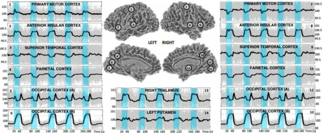 Figure 1.11 : Patrons d’activité BOLD synchronisée observés avec un moyennage  massif d’essais lors de stimulation visuelle