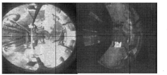 Figure 5-2  a) Flexion extrême latérale  b) Flexion latérale modérée 