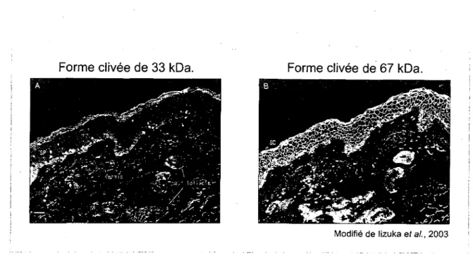 Figure 5. Patron de detection et localisation cellulaire des formes clivees de la TGM1 de  33 et 67 kDa dans la peau humaine