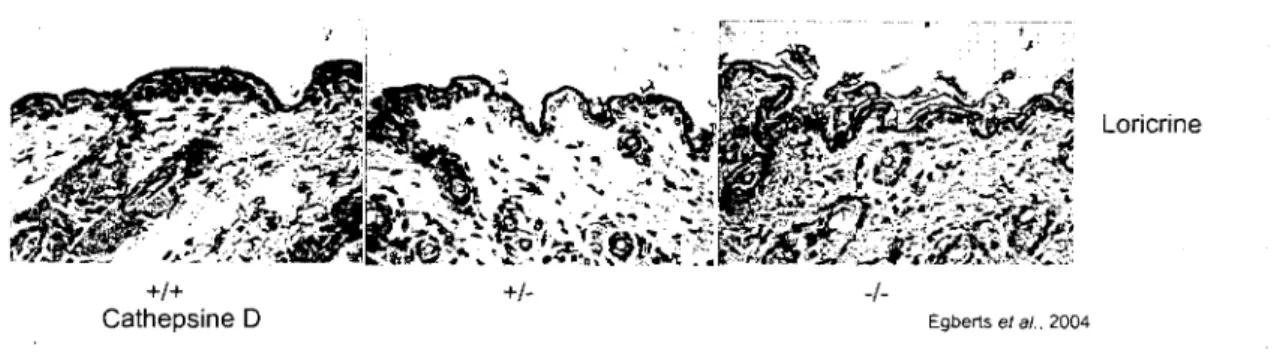 Figure 6. La deletion de la cathepsine D dans un modele murin entraine une  malformation de l'epiderme et une alteration des differents marqueurs de  differenciation terminate, dont la loricrine