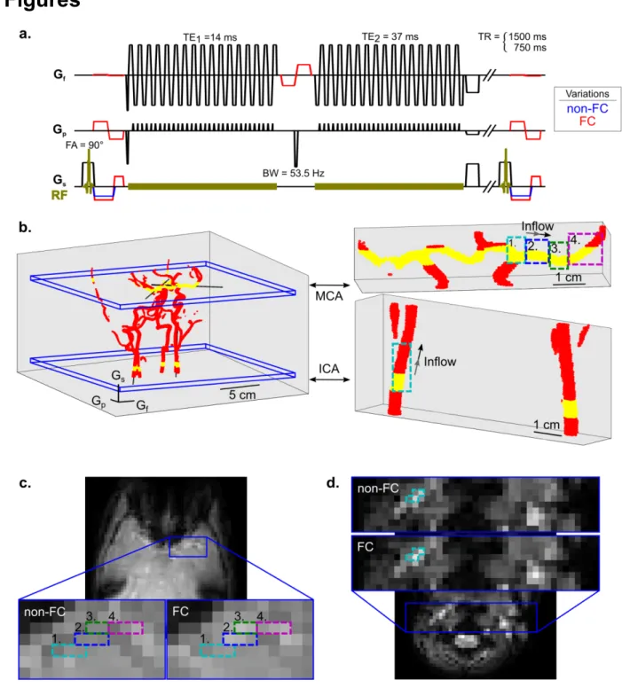FIG. 1. DSC sequence diagram with slice and ROI placement for measuring arterial blood signal