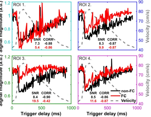 FIG. 3. Dynamic first echo signal sorted by trigger delay for each ROI in the MCA (Fig