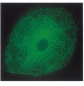 Fig. 6 : Amas de filaments intermédiaires de kératine ; structure protectrice épithéliale  Tiré de: (Mclean and  lrvine 2007) p.72 