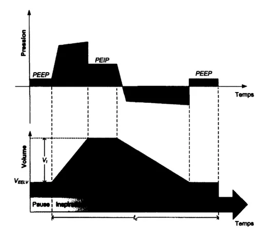 Figure  2.4  Principaux  volumes et  pressions lors d’un  cycle de VLT